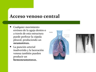 Acceso venoso central
 Cualquier movimiento
erróneo de la aguja dentro o
a través de esta estructura
puede perforar la cúpula
pleural, produciendo un
neumotórax.
 La punción arterial
inadvertida y la laceración
venosa también pueden
producir un
hemoneumotorax.
 