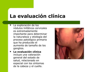 La evaluación clínica
 La exploración de los
nódulos linfáticos cervicales
es extremadamente
importante para determinar
la naturaleza y etiología del
proceso patológico primario
que ha producido el
aumento de tamaño de los
ganglios.
 La evaluación clínica
incluye una valoración
general del estado de
salud, relacionado en
especial con los síntomas
de la cabeza y el cuello.
 