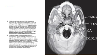 Formane Rasgado Anatomía del Cuello: Fascias, Espacios Profundos y Patología Asociada ...