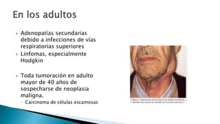  Adenopatías secundarias 
debido a infecciones de vías 
respiratorias superiores 
 Linfomas, especialmente 
Hodgkin 
 Toda tumoración en adulto 
mayor de 40 años de 
sospecharse de neoplasia 
maligna. 
◦ Carcinoma de células escamosas 
 