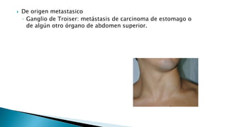  De origen metastasico 
◦ Ganglio de Troiser: metástasis de carcinoma de estomago o 
de algún otro órgano de abdomen superior. 
 