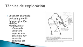  Localizar el ángulo 
de Louis y medir 
la ingurgitación. 
•Reflejo 
hepatoyugular 
•Cuando la 
vena cava 
superior esta 
obstruida, hay 
ausencia 
compleja del 
reflejo 
 