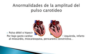  Pulso débil o hipocinético: 
Por bajo gasto cardiaco: insuficiencia ventricular izquierda, infarto 
al miocardio, miocardiopatía, pericarditis constrictiva… 
 