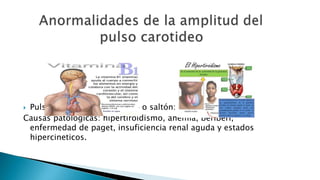  Pulso amplio e hipercinetico o saltón: 
Causas patológicas: hipertiroidismo, anemia, beriberi, 
enfermedad de paget, insuficiencia renal aguda y estados 
hipercineticos. 
 