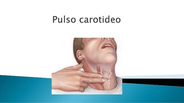 Cuello