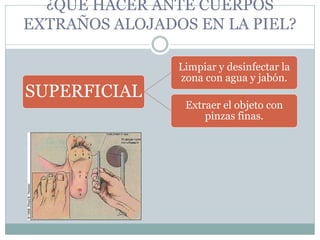 ¿QUÉ HACER ANTE CUERPOS
EXTRAÑOS ALOJADOS EN LA PIEL?
SUPERFICIAL
Limpiar y desinfectar la
zona con agua y jabón.
Extraer el objeto con
pinzas finas.
 