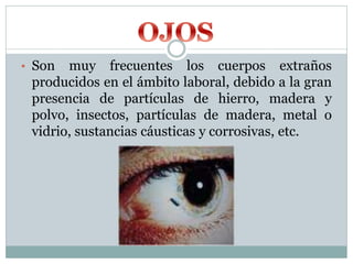 • Son muy frecuentes los cuerpos extraños
producidos en el ámbito laboral, debido a la gran
presencia de partículas de hierro, madera y
polvo, insectos, partículas de madera, metal o
vidrio, sustancias cáusticas y corrosivas, etc.
 