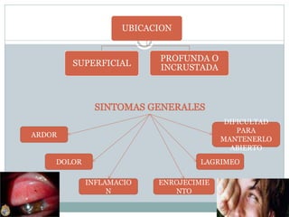 UBICACION
SUPERFICIAL
PROFUNDA O
INCRUSTADA
ARDOR
DOLOR
INFLAMACIO
N
ENROJECIMIE
NTO
LAGRIMEO
DIFICULTAD
PARA
MANTENERLO
ABIERTO
 