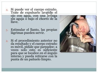4. Si puede ver el cuerpo extraño.
Trate de expulsarlo lavando el
ojo con agua, con una jeringa
sin aguja o bajo el chorro de la
llave.
5. Estimular el llanto, las propias
lágrimas pueden servir.
4. Si el procedimiento anterior no
da resultado y el cuerpo extraño
es móvil, pídale que parpadee; a
veces solo esto es suficiente
para que se localice en el ángulo
interno y pueda retirarse con la
punta de un pañuelo limpio.
 