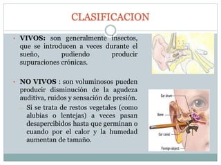 • VIVOS: son generalmente insectos,
que se introducen a veces durante el
sueño, pudiendo producir
supuraciones crónicas.
• NO VIVOS : son voluminosos pueden
producir disminución de la agudeza
auditiva, ruidos y sensación de presión.
– Si se trata de restos vegetales (como
alubias o lentejas) a veces pasan
desapercibidos hasta que germinan o
cuando por el calor y la humedad
aumentan de tamaño.
 