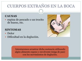 CUERPOS EXTRAÑOS EN LA BOCA
CAUSAS
 espina de pescado o un trocito
de hueso, etc.
SINTOMAS
 Dolor
 Dificultad en la deglución.
Intentaremos arrastrar dicha sustancia utilizando
algún alimento espeso y envolvente (miga de pan)
con los movimientos de deglución.
 