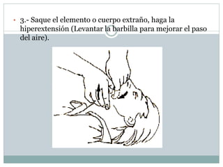 • 3.- Saque el elemento o cuerpo extraño, haga la
hiperextensión (Levantar la barbilla para mejorar el paso
del aire).
 