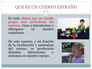 • Es todo objeto que no siendo
propio sino procedente del
exterior, viene a introducirse o
albergarse en nuestro
organismo.
• De esta manera, y en función
de la localización y naturaleza
del mismo, se producirán
distintas alteraciones o
síntomas en nuestro cuerpo.
 