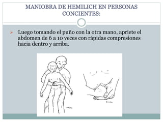  Luego tomando el puño con la otra mano, apriete el
abdomen de 6 a 10 veces con rápidas compresiones
hacia dentro y arriba.
 
