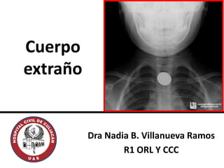 Cuerpo
extraño
Dra Nadia B. Villanueva Ramos
R1 ORL Y CCC
 