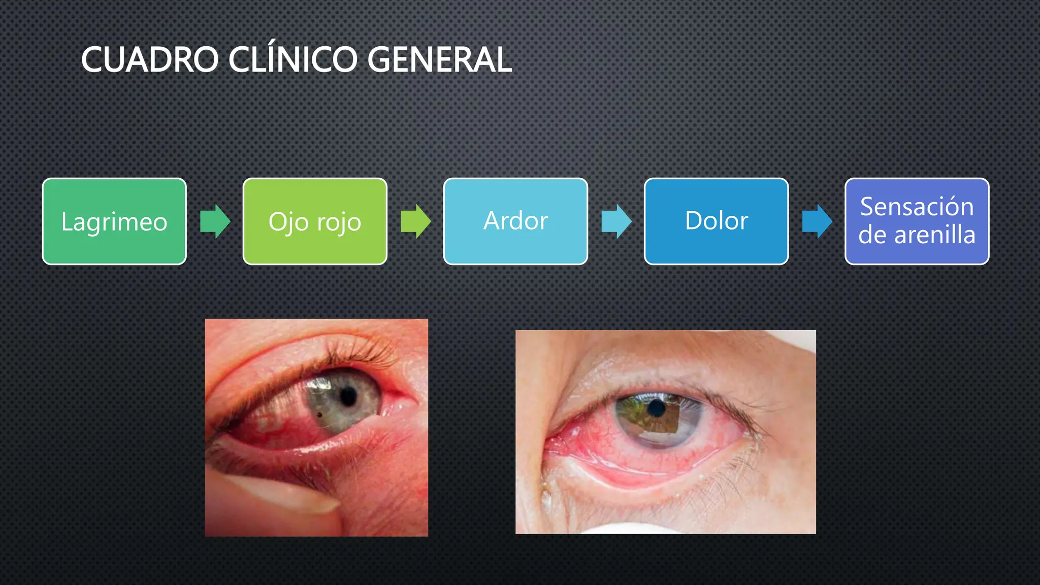 CUERPO EXTRAÑO SUPERFICIAL EN OJO .pptx