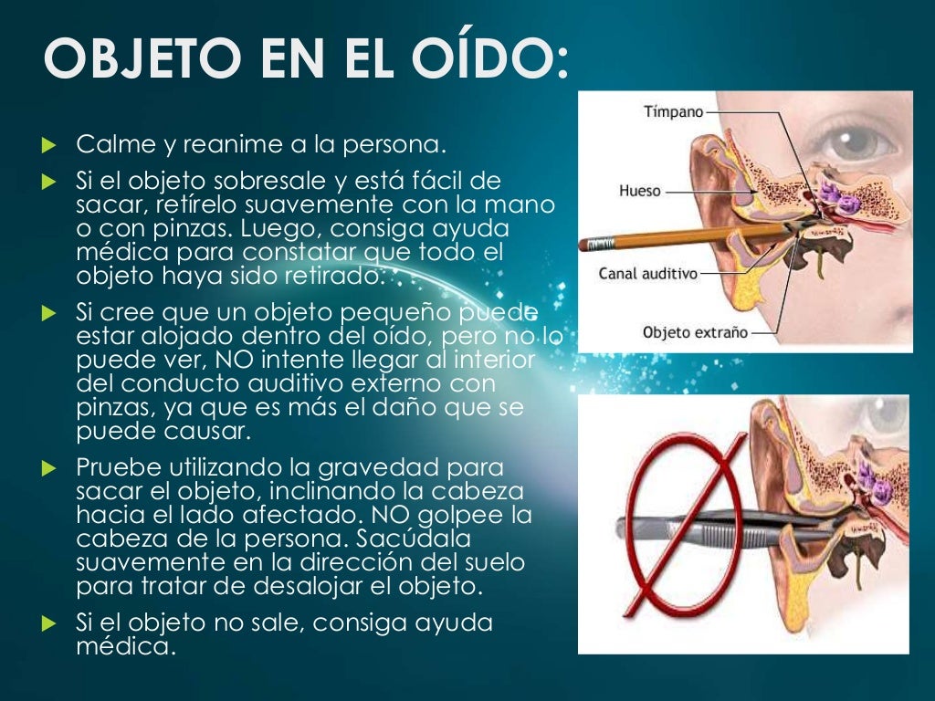 Primeros Auxilios en Cuerpos Extraños en Ojos, Nariz y Oídos Primeros Auxilios en Cuerpos Extraños en Ojos, Nariz y Oídos