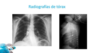 Radiografías de tórax
 