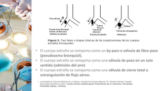 • Universidad de Ciencias Médicas de La Habana Facultad de Ciencias Médicas "Dr. Salvador Allende" Hospital
Neumológico Benéfico Jurídico Cuerpo extraño endobronquial. Presentación de un casoCalvo, Hernández,
Fernández, Sarduy , Córdova
• El cuerpo extraño se comporta como un by-pass o válvula de libre paso
(pseudoasma bronquial).
• El cuerpo extraño se comporta como una válvula de paso en un solo
sentido (admisión del aire)
• El cuerpo extraño se comporta como una válvula de cierre total o
estrangulación de flujo aéreo.
 