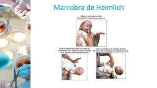 Maniobra de Heimlich
 