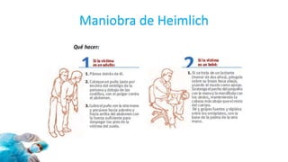 Maniobra de Heimlich
 