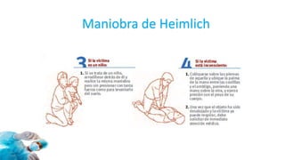 Maniobra de Heimlich
 
