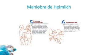 Maniobra de Heimlich
 