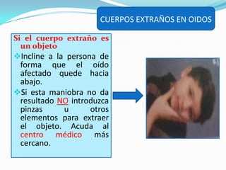 Evite que la victima se frote el ojo.