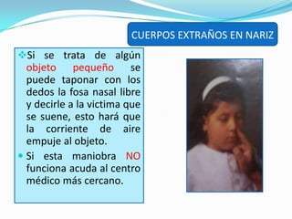 CUERPOS EXTRAÑOS EN OIDOSQué hacer si se trata de un insecto.Siente a la persona e incline la cabeza hacia el lado contrario del oído afectado. 