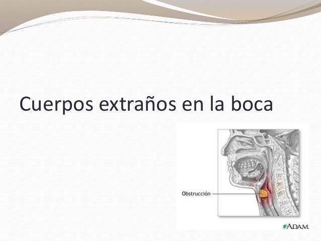 Soñar Con Espinas En La Boca