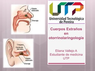 Cuerpos Extraños
en
otorrinolaringología
Eliana Vallejo A
Estudiante de medicina
UTP
 