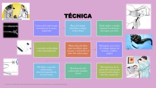 TÉCNICA
Cabeza del endoscopio
(tomada por la mano
izquierda)
Base del pulgar
(movilizar control
arriba/abajo)
Dedo índice y medio
(oprimir los botones
aire/agua, succión).
= controles arriba/abajo
y derecha/izquierda.
Mano derecha libre
para movilizar, girar,
avanzar y retroceder el
tubo del endoscopio.
Manipular accesorios
de trabajo (pinzas de
biopsia, cepillos,
agujas)
Movilizar controles
arriba/abajo,
derecha/izquierda de
ser necesario.
Movilización del
endoscopio (equipo
recto)
Movimientos de la
punta del endoscopio
(control arriba/abajo y
derecha /izquierda.
Córdoba Villalobos José Angel.Procedimientos endoscopicos en gastroenterología
 