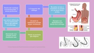 Detrás del cartílago
cricoaritenoideo o
senos piriformes
Luz estará obliterada
por la contracción
tónica del esfínter
cricofaringo.
Ejerciendo una
presión suave,
insuflando aire.
*Pedir al paciente
que degluta
Al sentir la
resistencia puedes
seguir avanzando
1/3 superior del
esófago
No soltar el tuvo y
mantener el control
a/a un poco hacia
arriba.
Siempre nos
deslizamos por
detrás de la laringe.
Córdoba Villalobos José Angel.Procedimientos endoscopicos en gastroenterología
 