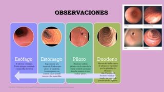 OBSERVACIONES
Esófago Estómago Píloro Duodeno
Uniforme y tubular.
Visión siempre orientada
a manecillas del reloj.
Ligeramente a la
izquierda. Endoscopio
girar a la izquierda,
levantar punta con
control a/a en sentido
inverso a las manecillas.
Mantener orificio
pilórico en el centro de la
visión (control a/a) mano
derecha sostiene el tuvo
realizar ajustes.
Mucosa del bulbo carece
de pliegues y rugosidad
por las glándulas de
Brunner.
2da. Porción del
duodeno localizar el
ángulo que esta en la
porción media superior.
Córdoba Villalobos José Angel.Procedimientos endoscopicos en gastroenterología
 