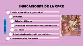 INDICACIONES DE LA CPRE
Fístula biliar o fístula pancreática
Tumores
Cálculos biliares
Inflamación debido a traumatismo o enfermedad
Infección
Oclusión inadecuada de válvulas o esfínteres
Esclerosis de los conductos
Córdoba Villalobos José Angel.Procedimientos endoscopicos en gastroenterología
OBSTRUCCIÓN
 