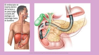 Córdoba Villalobos José Angel.Procedimientos endoscopicos en gastroenterología
 