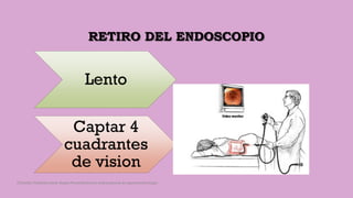 RETIRO DEL ENDOSCOPIO
Lento
Captar 4
cuadrantes
de vision
Córdoba Villalobos José Angel.Procedimientos endoscopicos en gastroenterología
 