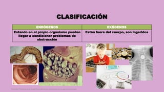 CLASIFICACIÓN
ENDÓGENOS EXÓGENOS
Estando en el propio organismo pueden
llegar a condicionar problemas de
obstrucción
Están fuera del cuerpo, son ingeridos
Córdoba Villalobos José Angel.Procedimientos endoscopicos en gastroenterología
 