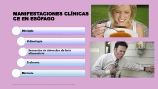MANIFESTACIONES CLÍNICAS
CE EN ESÓFAGO
Disfagia
Odinofagia
Sensación de detección de bolo
alimenticio
Sialorrea
Disfonia
Córdoba Villalobos José Angel.Procedimientos endoscopicos en gastroenterología
 