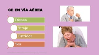 CE EN VÍA AÉREA
Disnea
Tiraje
Estridor
Tos
Córdoba Villalobos José Angel.Procedimientos endoscopicos en gastroenterología
 