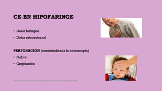 CE EN HIPOFARINGE
• Dolor faríngeo
• Dolor retroesternal
PERFORACIÓN (contraindicada la endoscopía)
• Fiebre
• Crepitación
Córdoba Villalobos José Angel.Procedimientos endoscopicos en gastroenterología
 