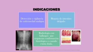 INDICACIONES
Detección y vigilancia
de enfermedad maligna
Biopsia de intestino
delgado
Radiología con
hallazgos que
requieran confirmación
histológica o cuando
exista duda.
Córdoba Villalobos José Angel.Procedimientos endoscopicos en gastroenterología
 