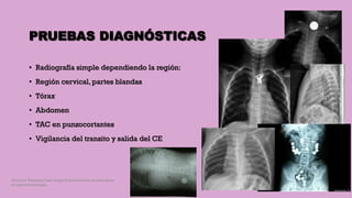 PRUEBAS DIAGNÓSTICAS
• Radiografía simple dependiendo la región:
• Región cervical, partes blandas
• Tórax
• Abdomen
• TAC en punzocortantes
• Vigilancia del transito y salida del CE
Córdoba Villalobos José Angel.Procedimientos endoscopicos
en gastroenterología
 