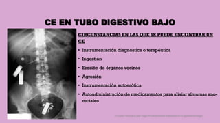 CE EN TUBO DIGESTIVO BAJO
CIRCUNSTANCIAS EN LAS QUE SE PUEDE ENCONTRAR UN
CE
• Instrumentación diagnostica o terapéutica
• Ingestión
• Erosión de órganos vecinos
• Agresión
• Instrumentación autoerótica
• Autoadministración de medicamentos para aliviar síntomas ano-
rectales
Córdoba Villalobos José Angel.Procedimientos endoscopicos en gastroenterología
 