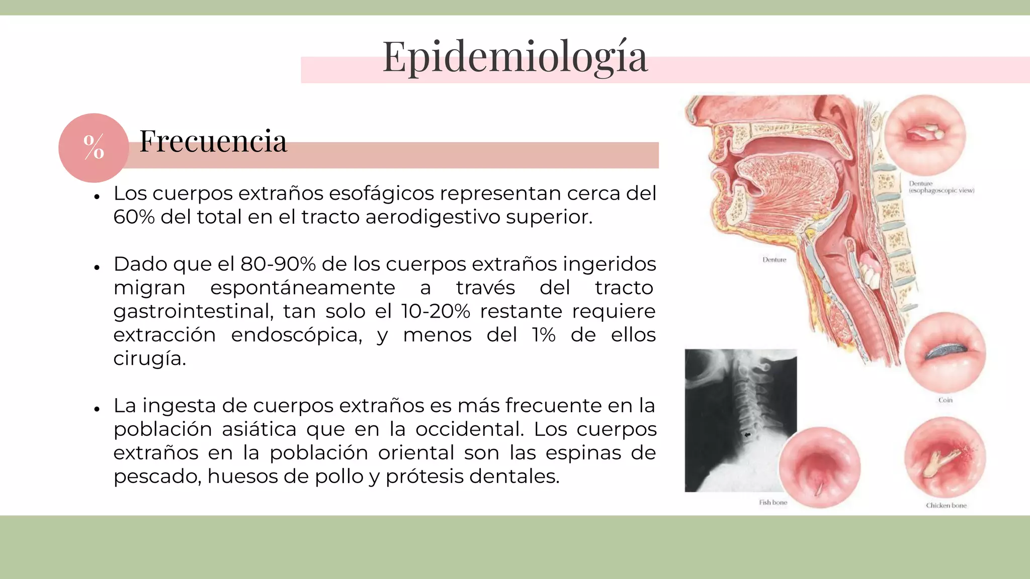 CUERPOS EXTRAÑOS EN ESÓFAGO