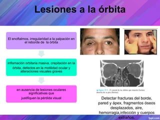 Lesiones a la órbita
Detectar fracturas del borde,
pared y ápex, fragmentos óseos
desplazados, aire,
hemorragia,infección y cuerpos
extraños.
El enoftalmos, irregularidad a la palpación en
el reborde de la órbita
inflamación orbitaria masiva, crepitación en la
órbita, defectos en la motilidad ocular y
alteraciones visuales graves
en ausencia de lesiones oculares
significativas que
justifiquen la pérdida visual
 