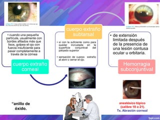 • cuando una pequeña
partícula, usualmente con
bordes afilados más que
lisos, golpea el ojo con
fuerza insuficiente para
pasar completamente a
través de la córnea
cuerpo extraño
corneal
• sí con la suficiente como para
quedar incrustada en la
superficie conjuntival del
párpado superior
• sensación de cuerpo extraño
al abrir o cerrar el ojo.
cuerpo extraño
subtarsal • de extensión
limitada después
de la presencia de
una lesión contusa
ocular u orbitaria.
Hemorragia
subconjuntival
anestésico tópico
(calibre 18 o 21).
Tx. Abrasión corneal
“anillo de
óxido.
 