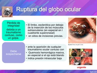 • El limbo, esclerótica por debajo
de la inserción de los músculos
extraoculares (en especial en l
cuadrante superonasal)
• en sitios de incisiones previas.
Pérdida de
integridad
debida a un
traumatismo
contuso, como
un golpe.
• ante la aparición de cualquier
traumatismo ocular contuso con
• Quemosis hemorrágica masiva,
en especial si el ojo está blando
• indica presión intraocular baja
Debe
sospecharse
urgente
 