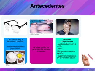 Antecedentes
Circunstancias y el
mecanismo de lesión
anormalidad oftálmica
preexistente
se interrogará a las
personas que estaban
presentes.
pacientes
cooperadores
-cambio subjetivo en la
visión
-Dolor
-Sensación de cuerpo
extraño
Sugerir anormalidades
en la superficie ocular
 