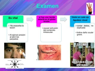 Examen
Es vital
• No exacerbe la
lesión
• Al ejercer presión
al abrir los
parpados
si hay una herida
abierta en el globo
ocular.
• causar extrusión
del contenido
intraocular.
Visión en cada ojo
Agudeza visual
• contar dedos, no
explicada
• Indica daño ocular
grave.
 